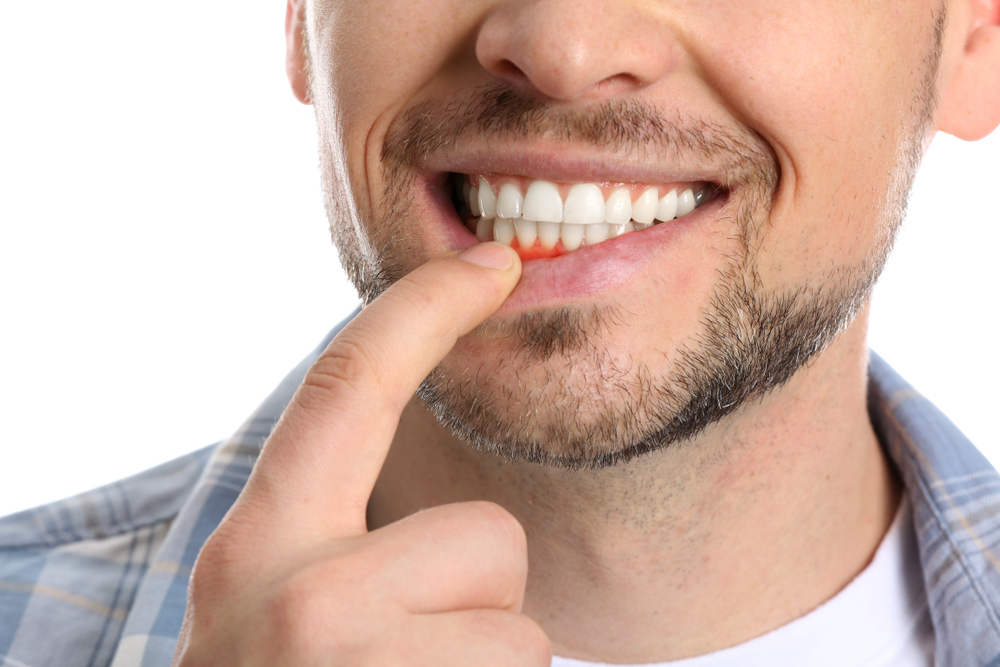 man shows off gum inflammation from periodontal issues