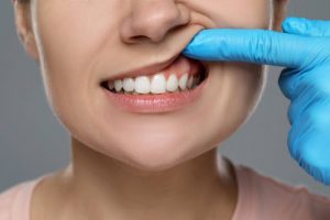 patients gum and teeth are examined by dentist