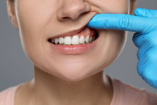 dentist examines patient’s gums for signs of infection